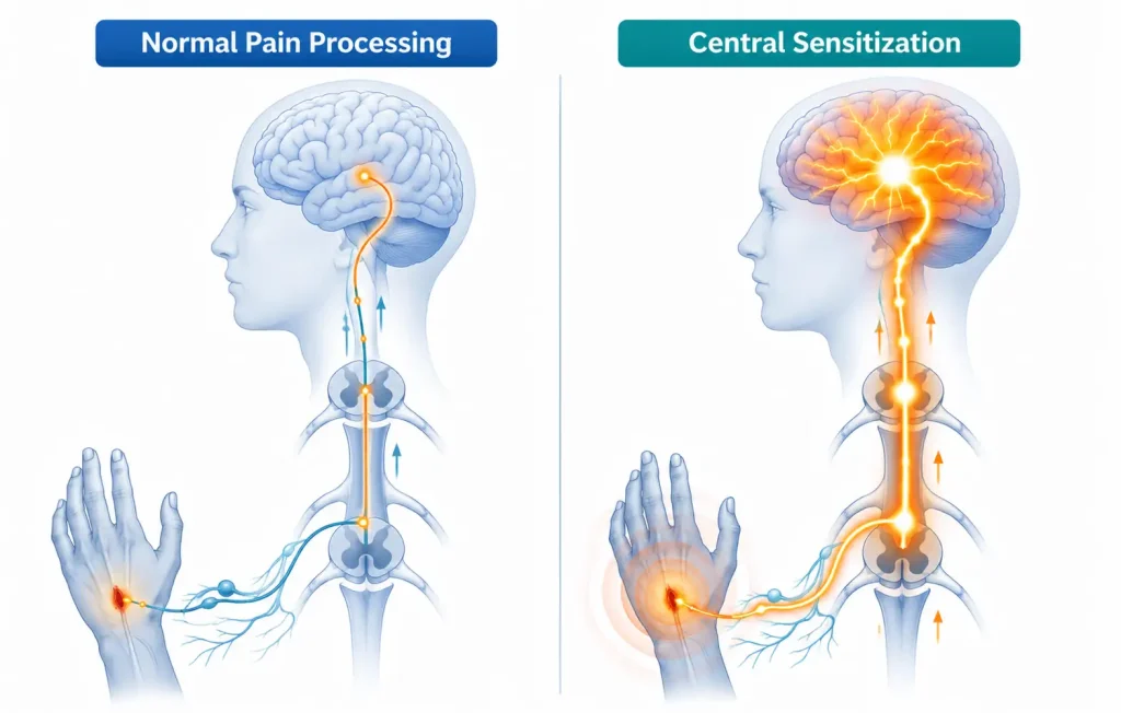 Medical infographic comparing normal pain processing and central sensitization, showing how pain signals become amplified in chronic pain.